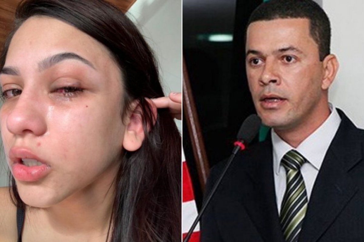 Vereador acusado de agredir a filha em Campo Formoso é preso