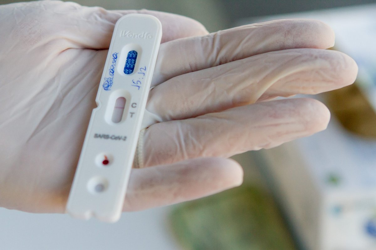 Pesquisadores australianos desenvolvem teste capaz de detectar covid-19 em 20 minutos