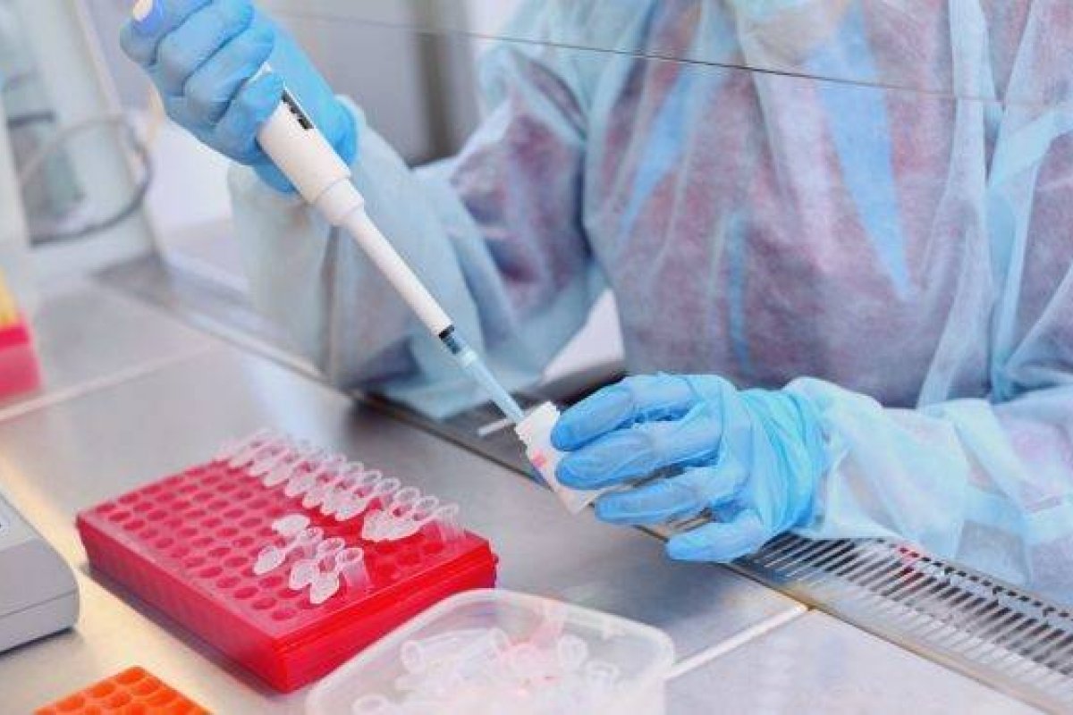 Remédio para hepatite reduz em quase 80% a chance de agravamento de Covid-19