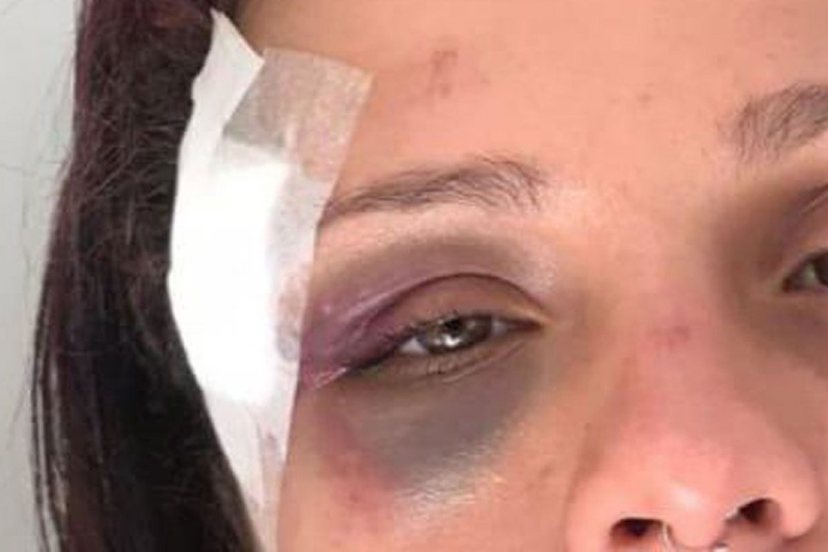 Mulher denuncia lutador de jiu-jítsu por agressão em Salvador