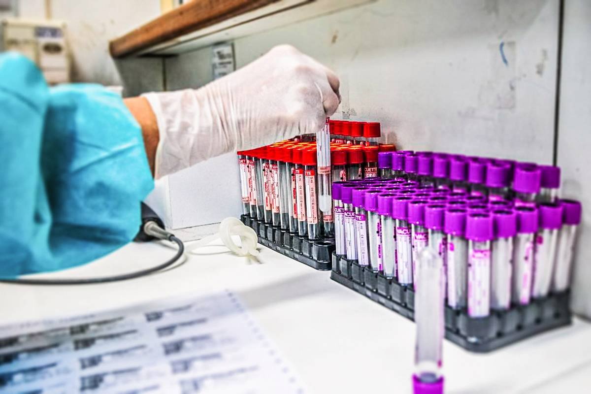 Johnson & Johnson inicia testes de vacina contra Covid-19 em humanos