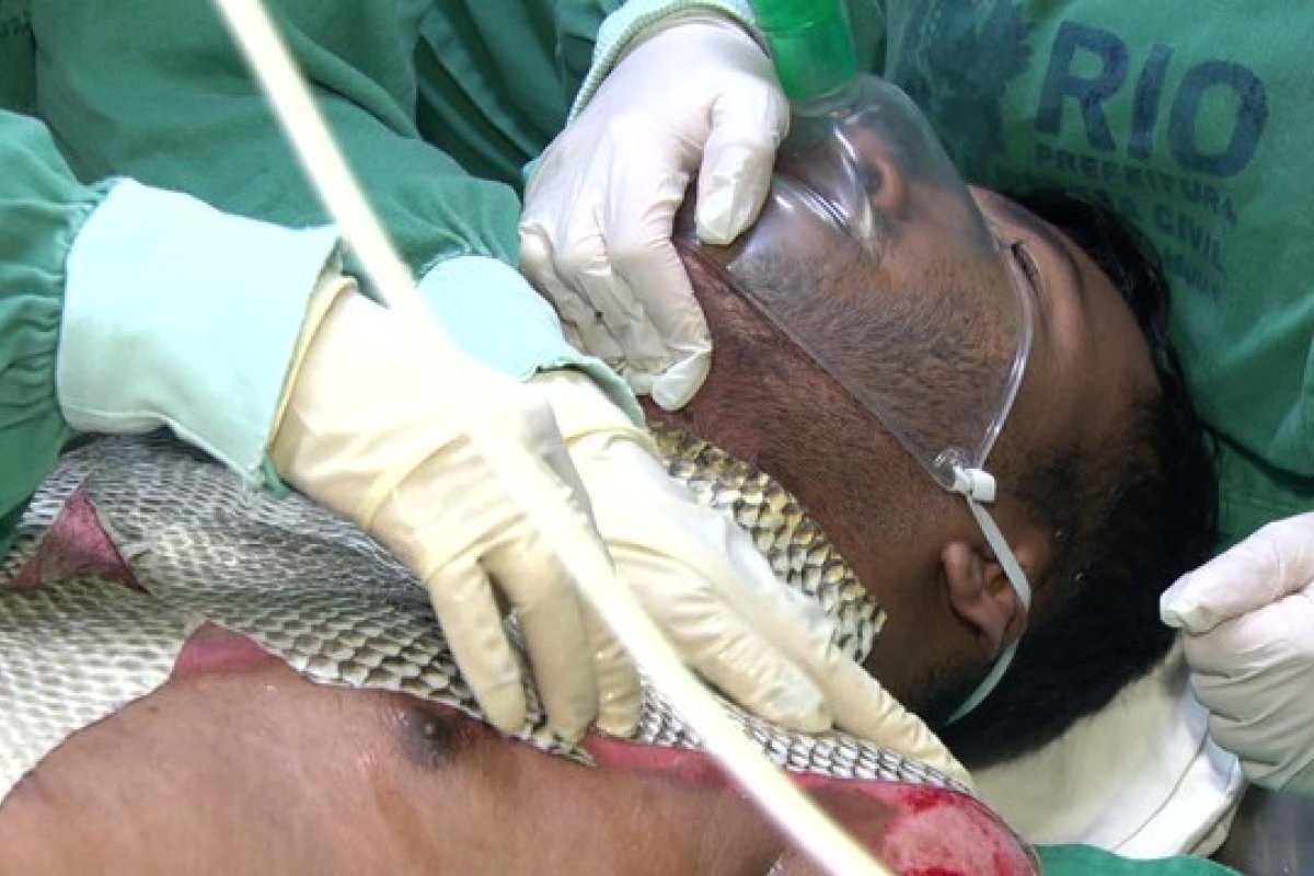 Pesquisadores brasileiros se mobilizam para enviar pele de tilápia ao Líbano