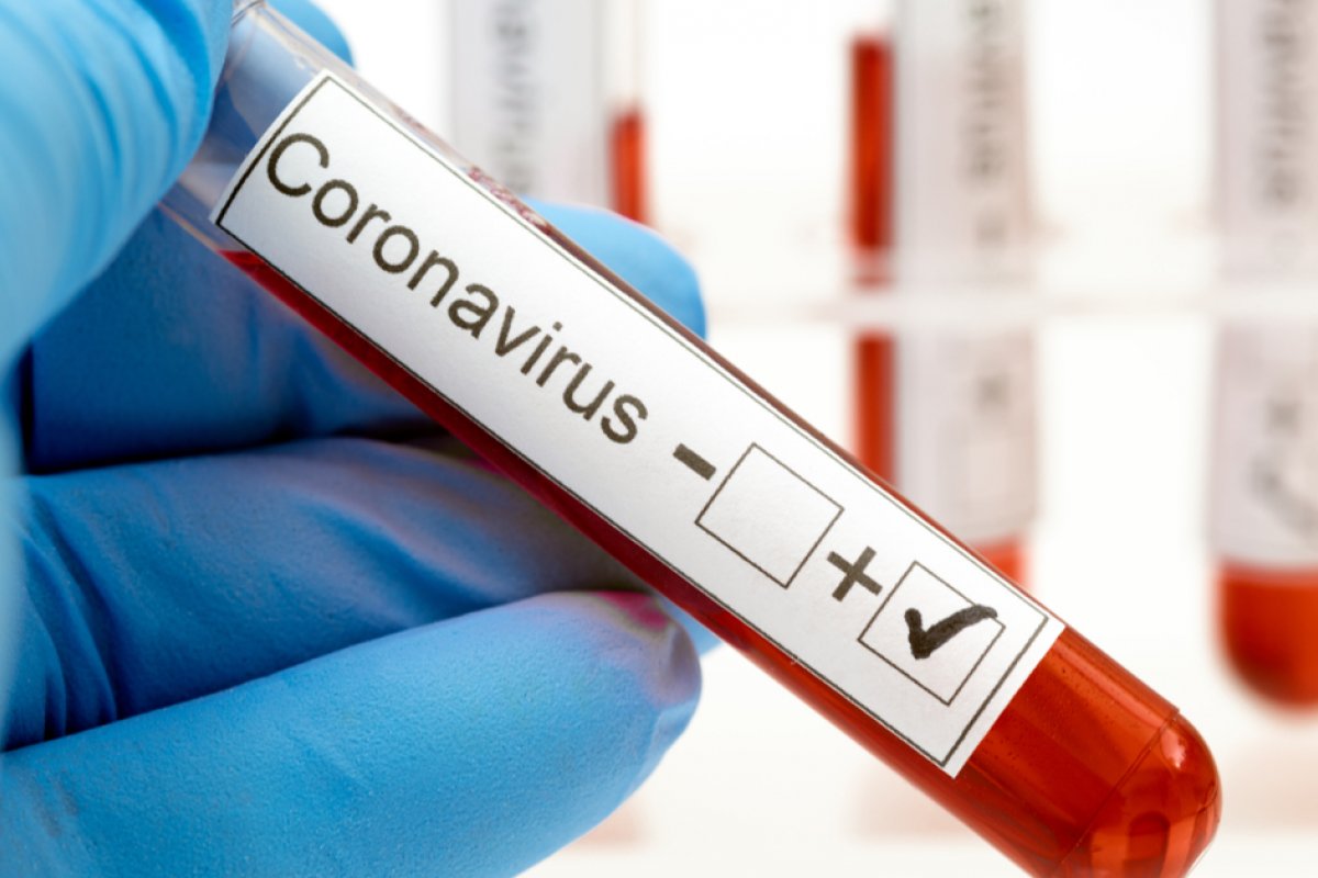 Recuperados da Covid-19 dizem sentir fadiga muscular e cansaço respiratório, diz estudo