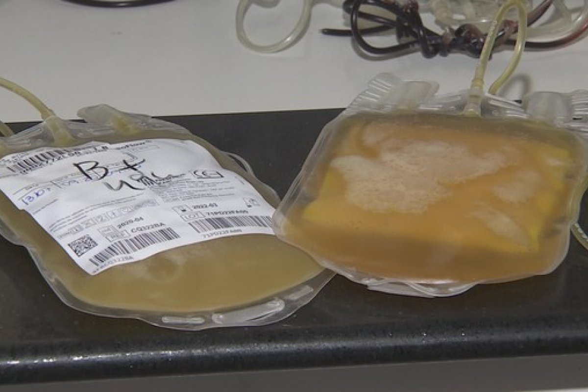 TCU e MP apontam desperdício de quase 600 mil litros de plasma desde 2017