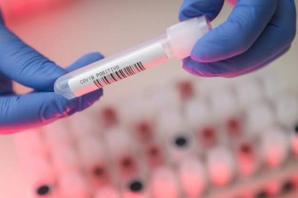 Filha da primeira morta por coronavírus afirma que perdeu outros parentes para a doença