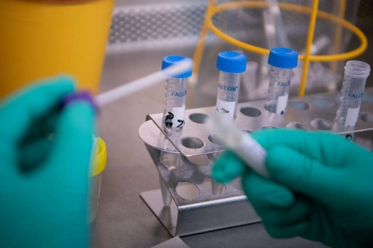 Pesquisadores brasileiros analisam perfis clínicos da Covid-19