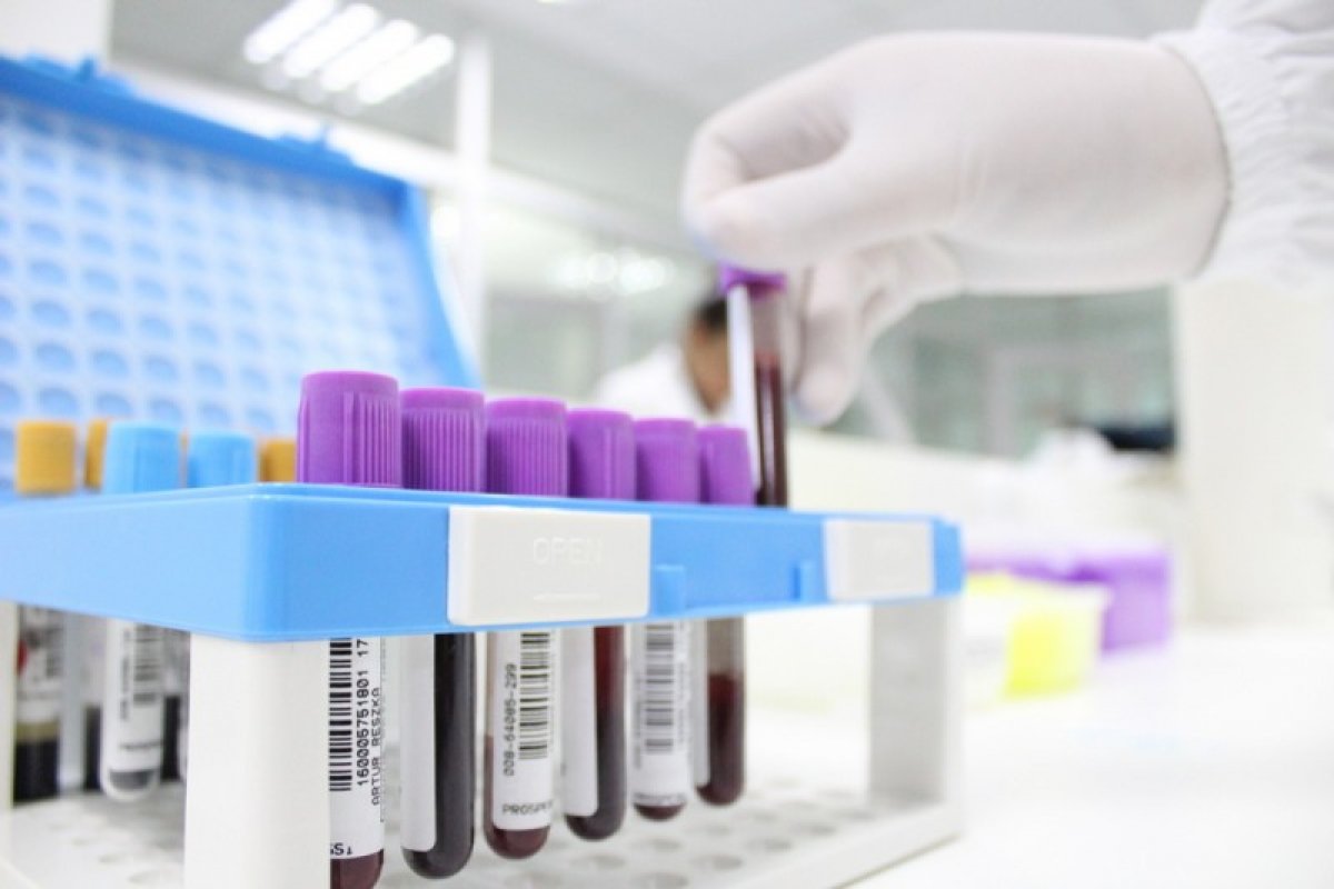 Estudo encontra novos sinais de danos ao sistema circulatório provocados pela Covid-19