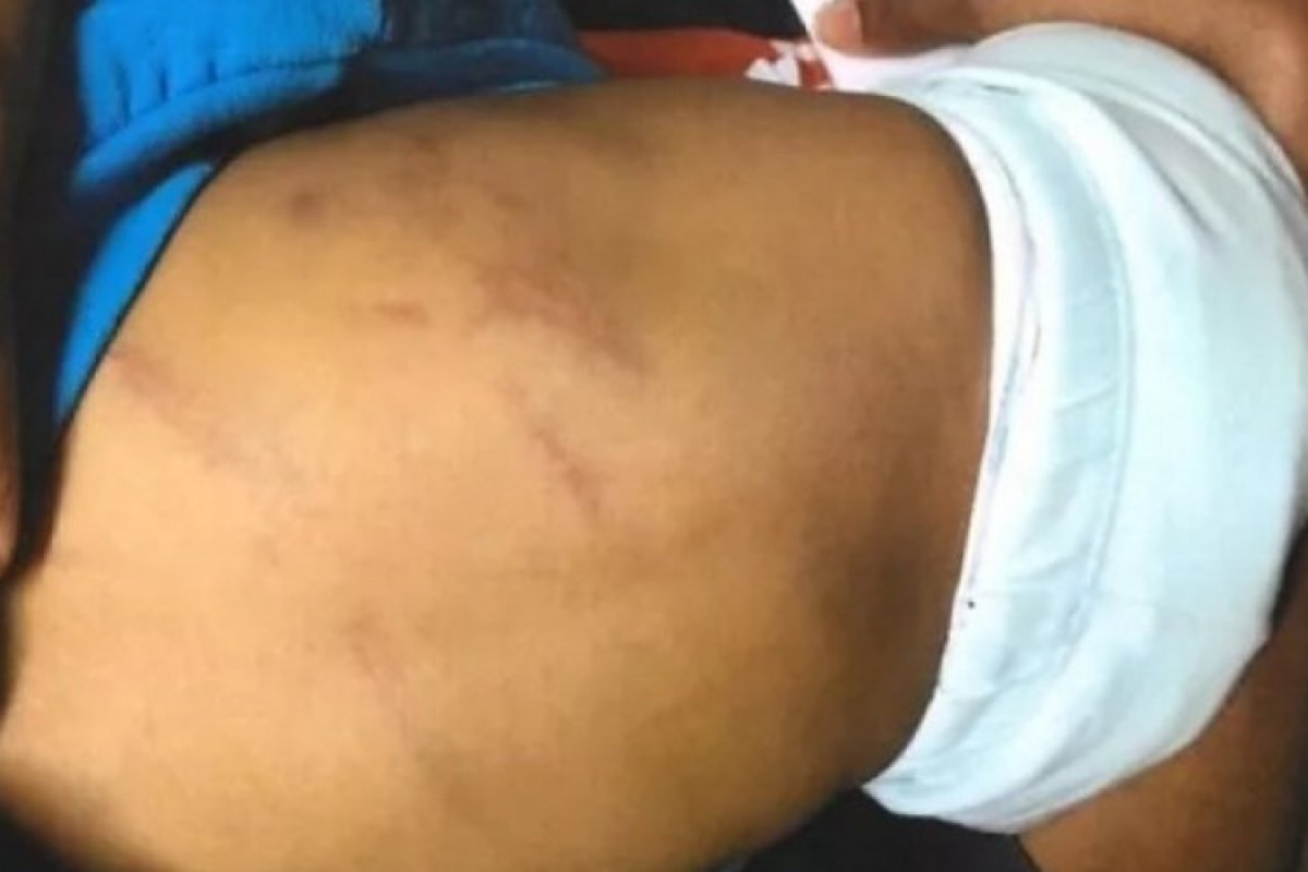 Padrasto é acusado de chicotear bebê de nove meses