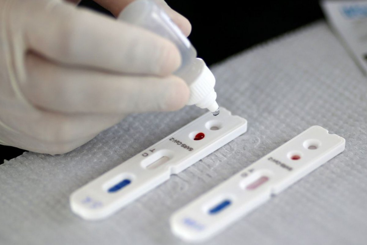 Cerca de 120 mil testes contra a covid-19 já foram distribuídos em Salvador