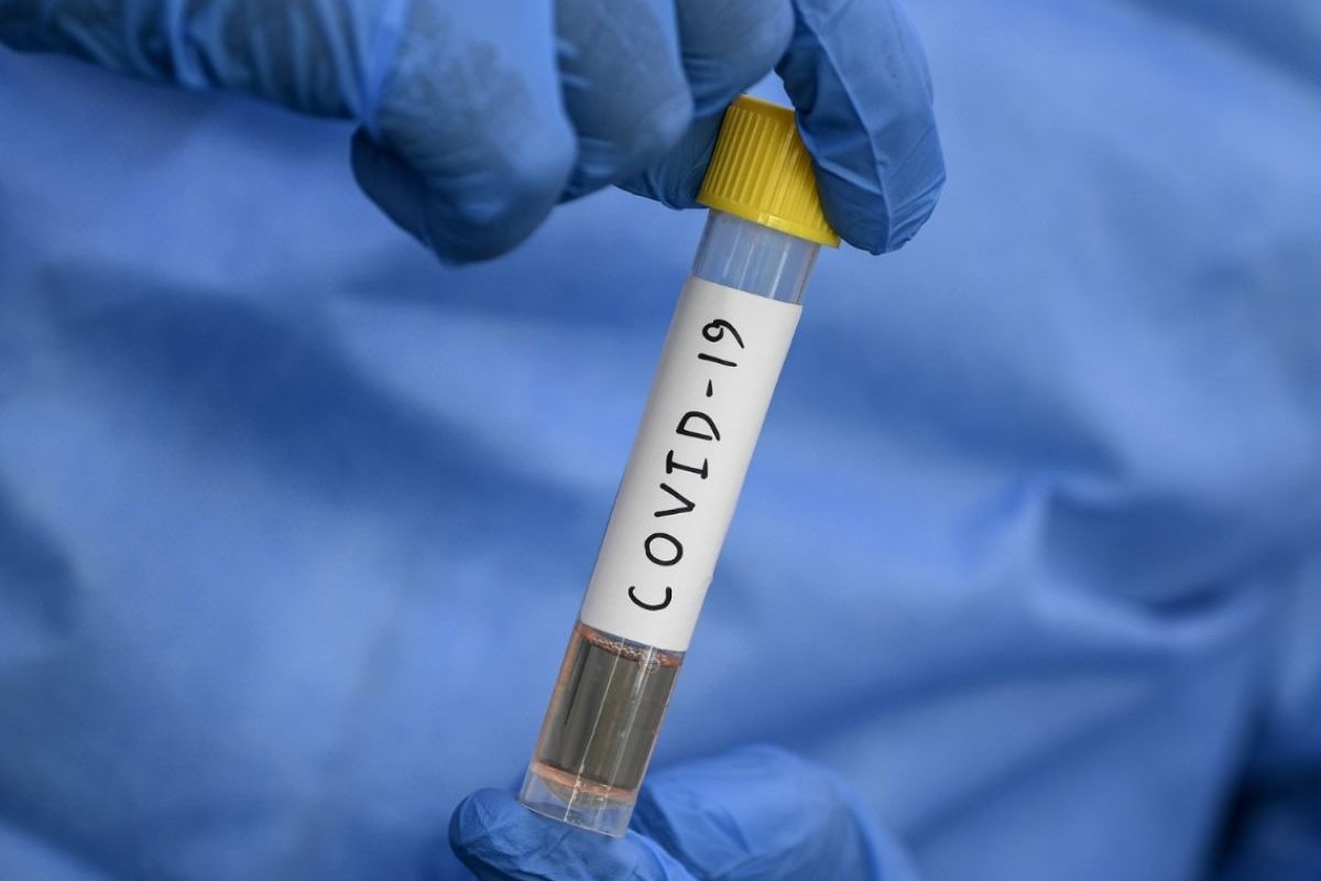 Brasil se aproxima dos 3,9 milhões de casos confirmados de Covid-19