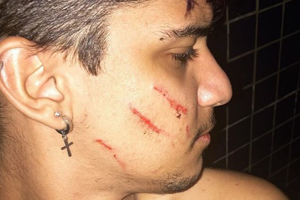 Após relatar agressão nas redes socais, jovem diz ter sido alvo de ataque homofóbico