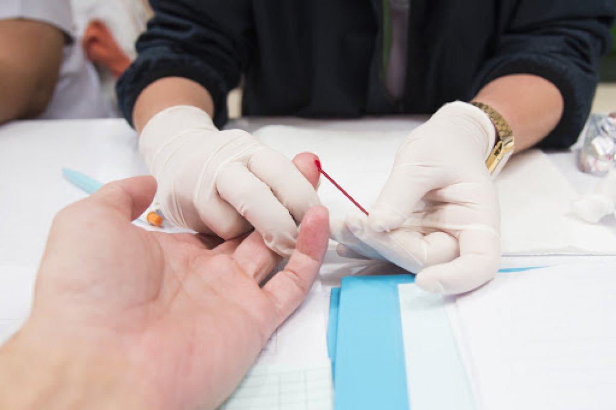 Pandemia do coronavírus pode impactar diagnósticos de HIV