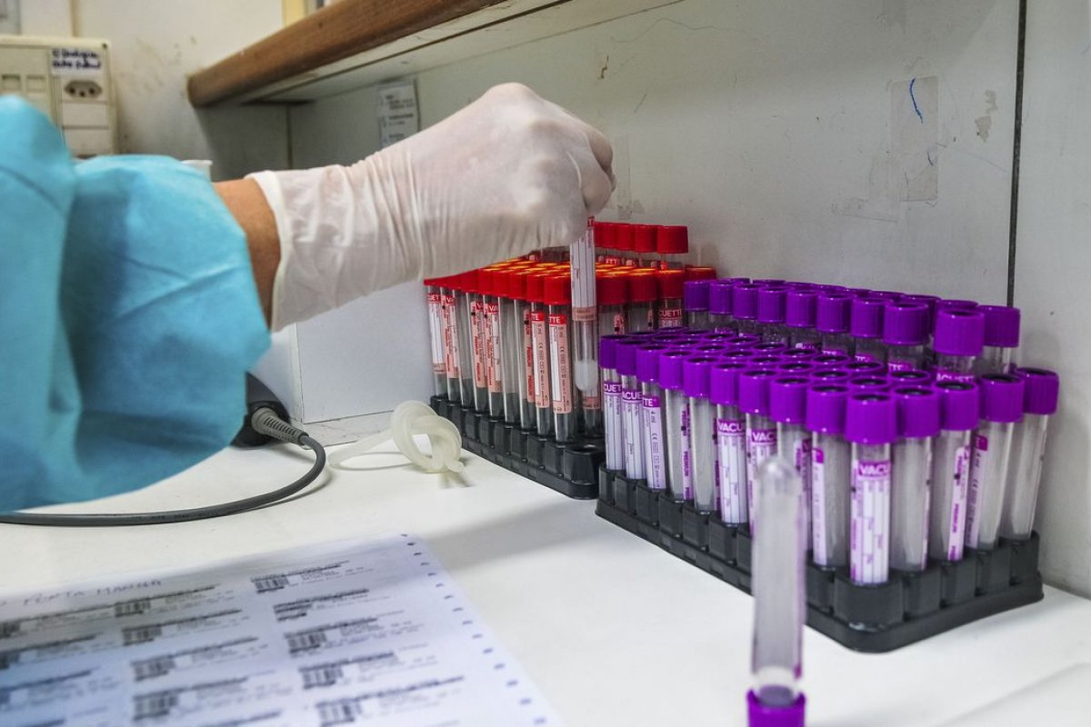 Pesquisadores da UFRJ desenvolvem teste para detecção do novo coronavírus 20 vezes mais barato