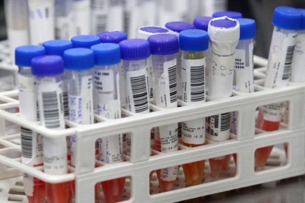 Veja os últimos dados da pandemia nesta terça-feira (15)