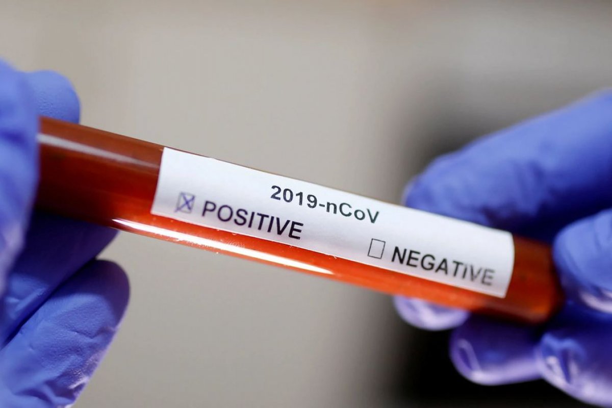 OMS diz que aceleração da pandemia em setembro na Europa é preocupante