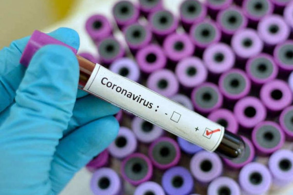 Covid: Bahia registra 1.093 casos e 1.094 curados nas últimas 24h