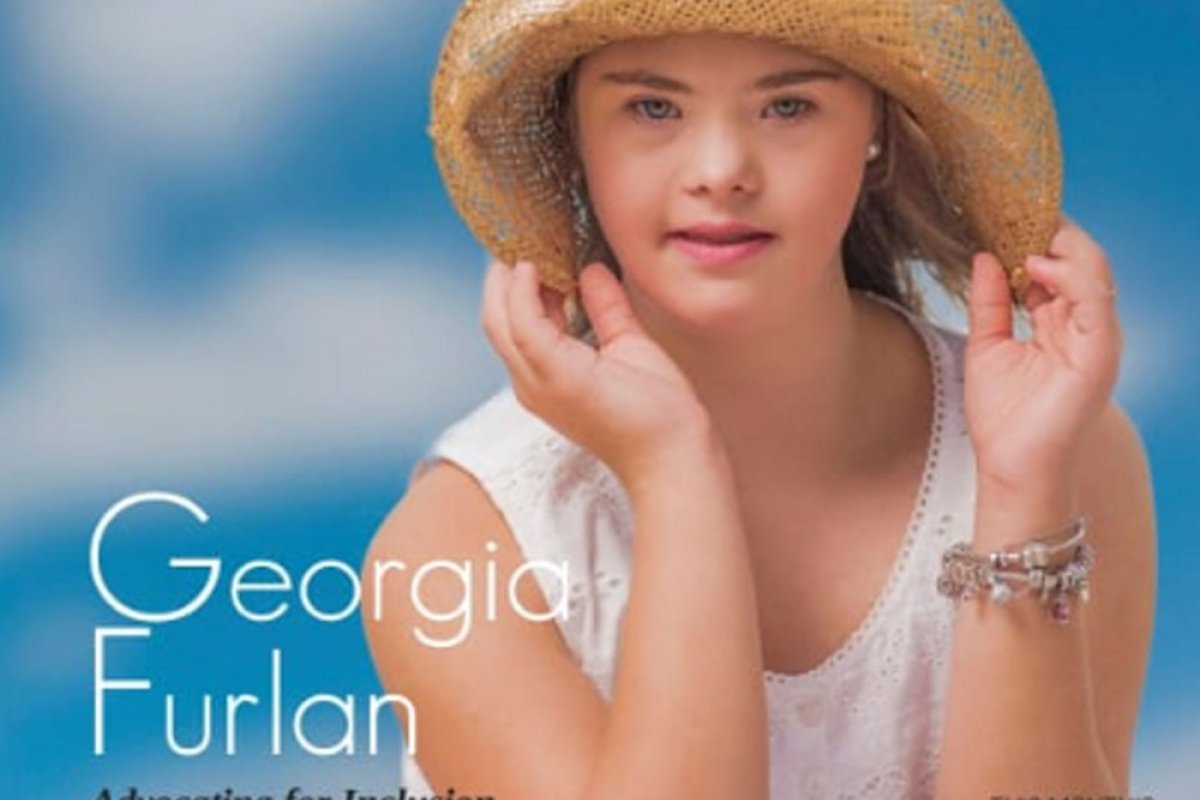 Brasileira com síndrome de down é capa de revista australiana