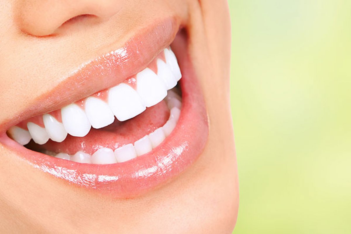 Clareamento dental: fique por dentro dos tipos e novidades