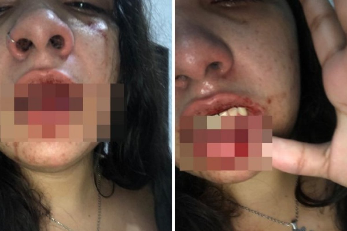 Jovem de 18 anos acusa irmão de agressão e diz ter sido expulsa de casa