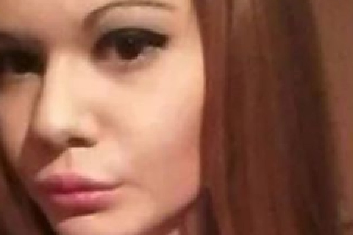 Barbie Humana toma 21º injeção para ter maiores lábios do mundo