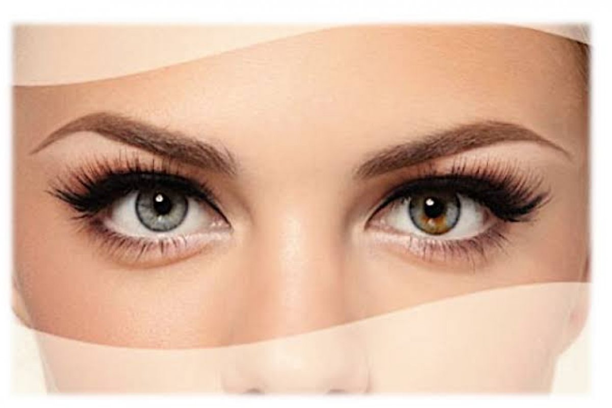 Dobras de pele nas pálpebras (festoons) têm tratamento?