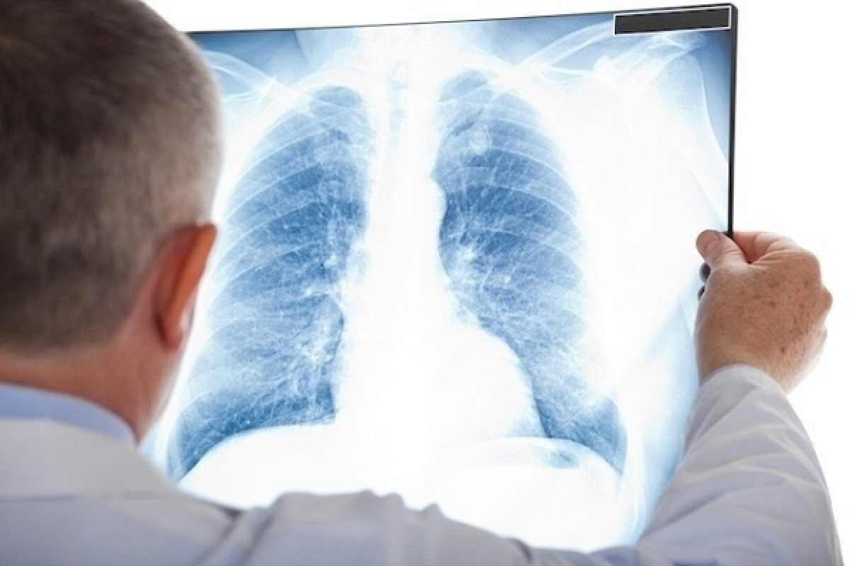 Fiocruz aponta tendência de aumento de síndromes respiratórias aguda grave em 7 capitais