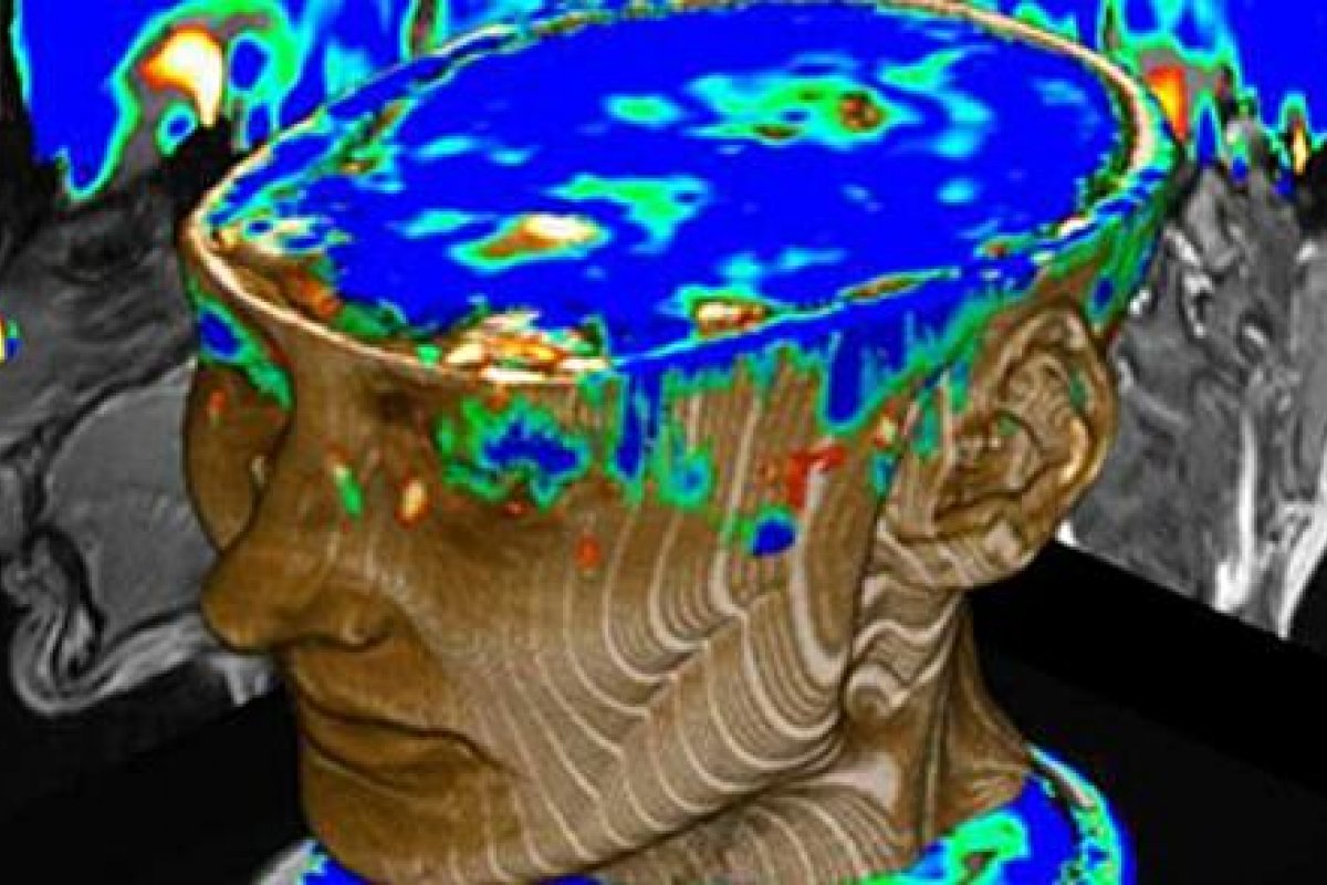 Exame genético indica medicamentos mais eficazes para tratamentos psiquiátricos