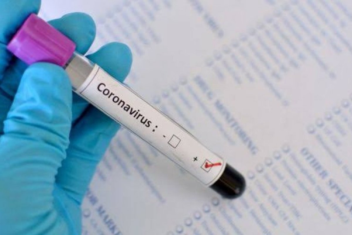 Covid-19: mais 1.575 novos casos são registrados na Bahia