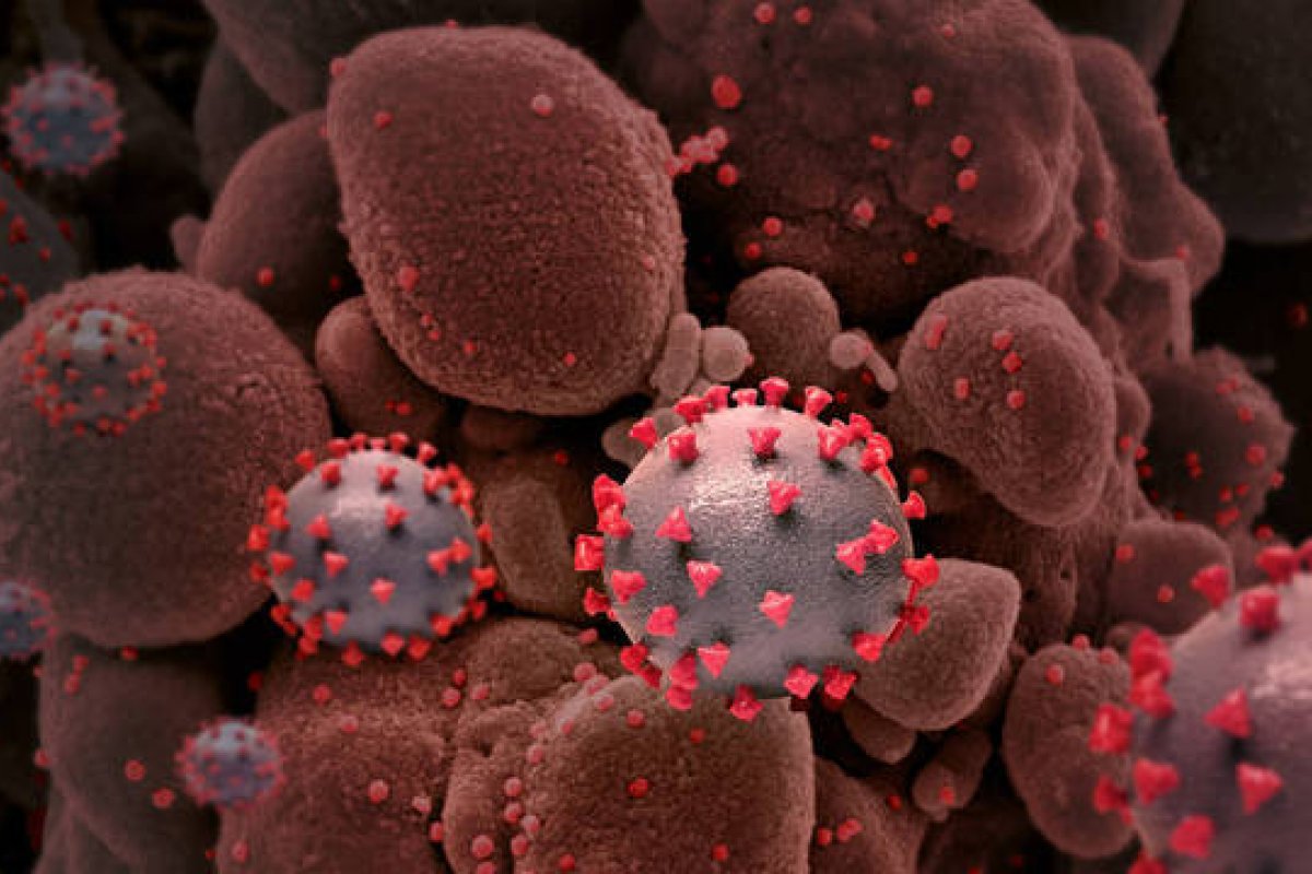 Exame de sangue pode prever quem vai desenvolver Covid-19 grave