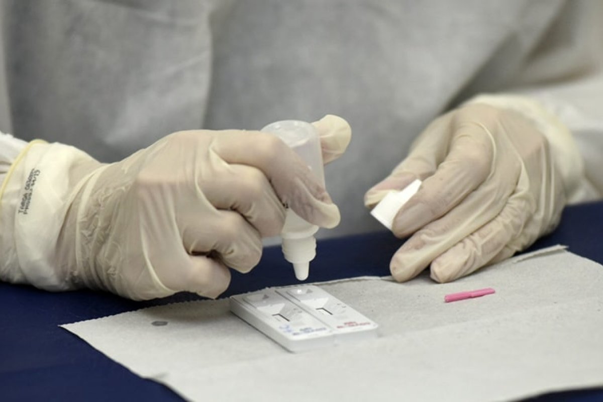 Brasil reduz número de testes de Covid-19 em setembro, aponta Ministério da Saúde