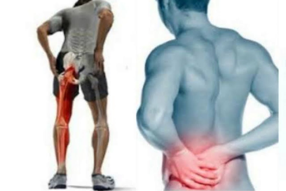 Tudo que você precisa saber sobre dor no ciático