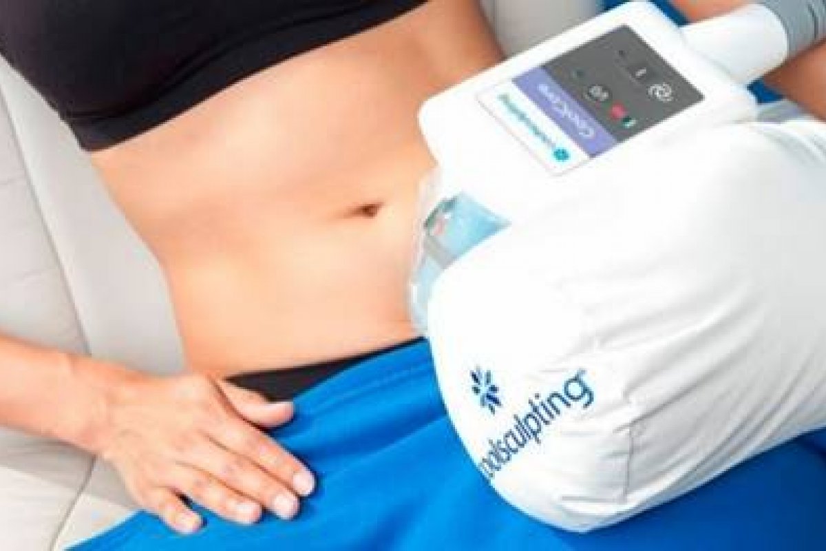 Conheça o procedimento CoolSculpting® para modelar o corpo no pré-verão