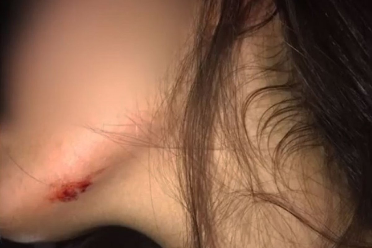 Ex-namorado agride adolescente com pedradas no interior da Bahia.