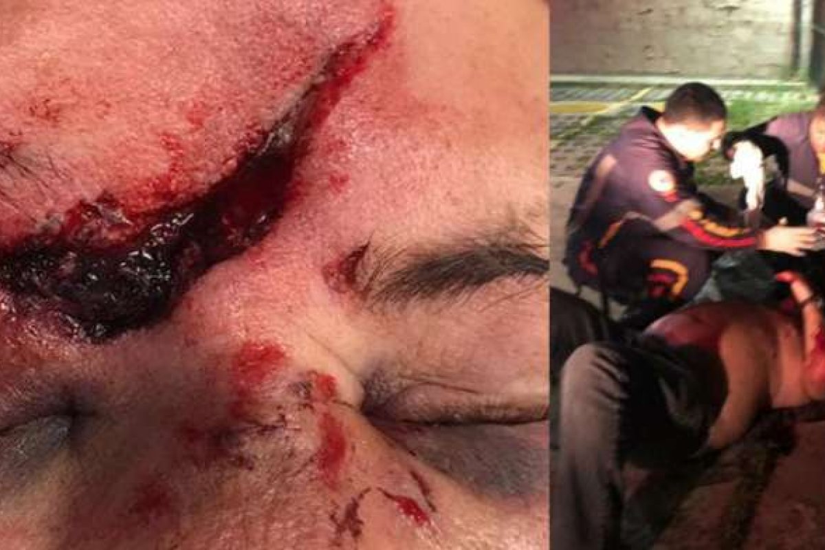 Homem é espancado após acidente de trânsito em Lauro de Freitas