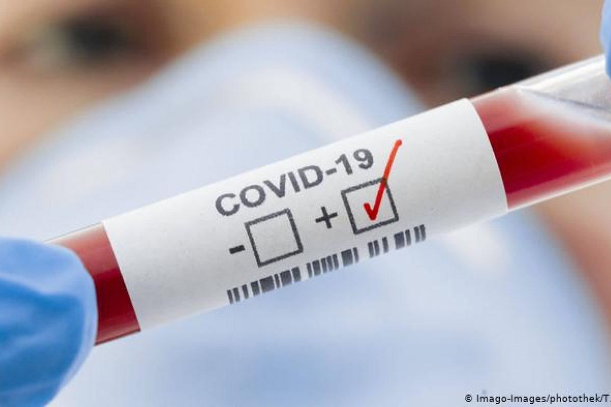 Mundo atinge 45 milhões de infectados por covid-19