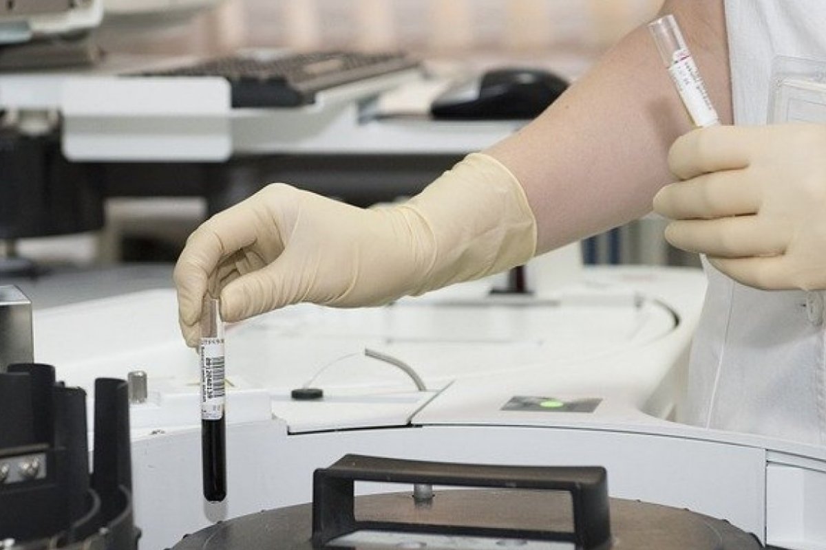 Número de pacientes com diagnóstico tardio de câncer de pulmão chega a 100% na Bahia