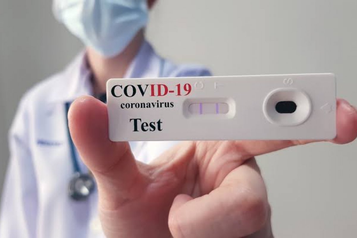 Na pandemia da Covid-19, SUS realizou mais de 17 milhões de testes