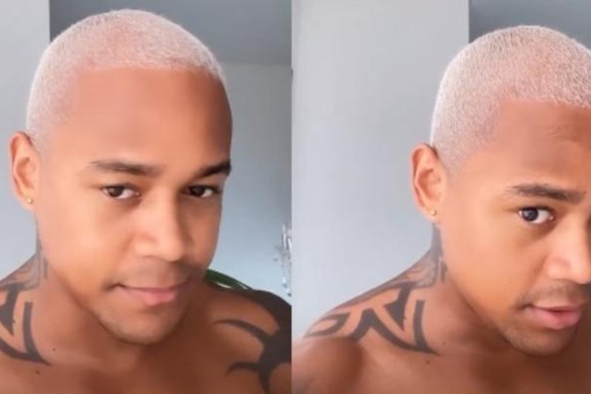 Léo Santana mostra antes e depois de transplante capilar