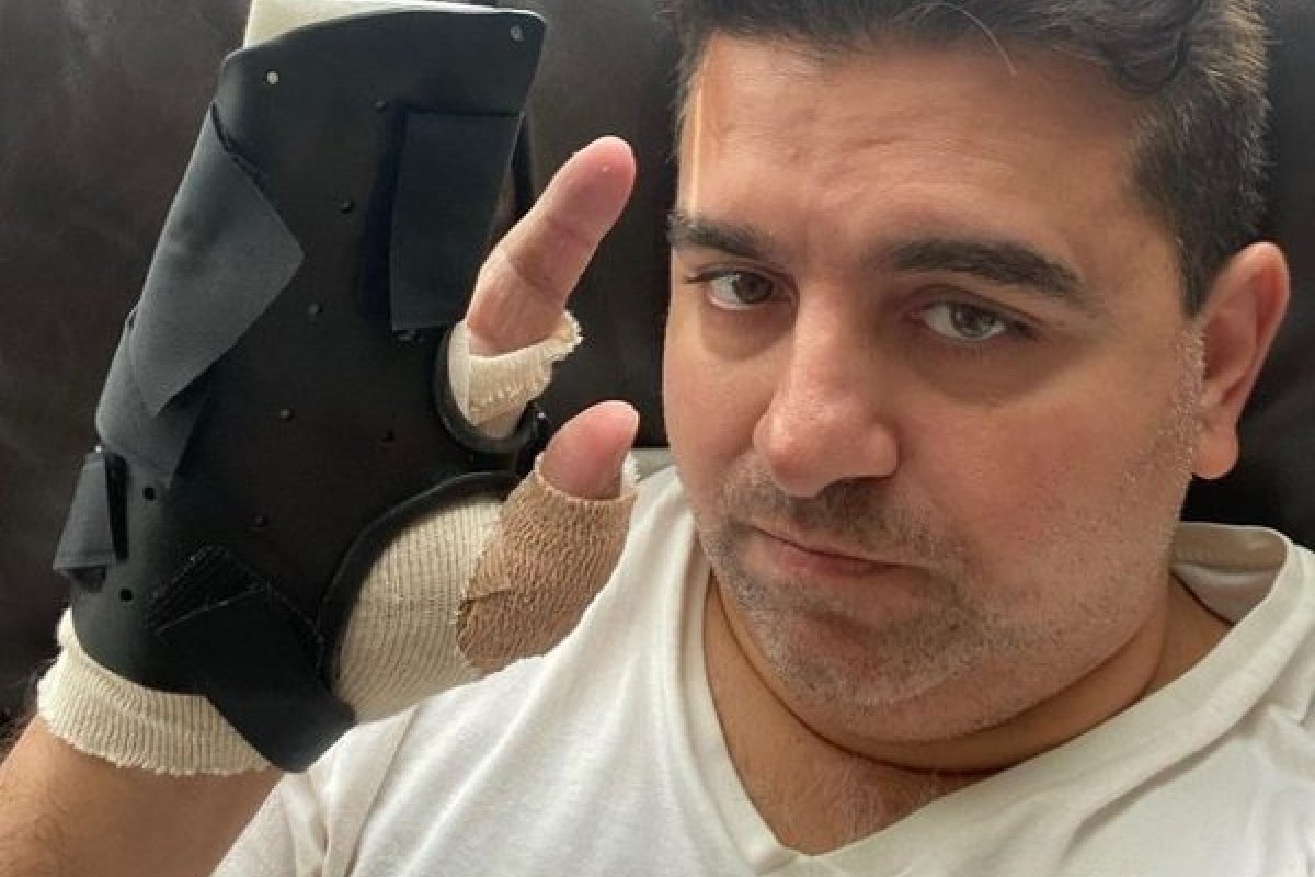 Tristeza: Buddy Valastro diz que pode não voltar à confeitaria após grave acidente na mão