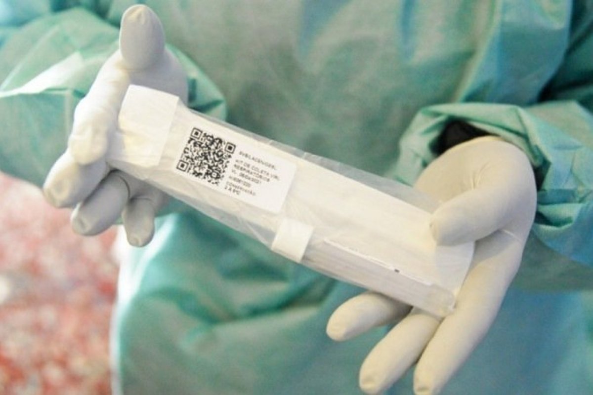 Governo federal pode jogar 6,8 milhões de testes de Covid-19