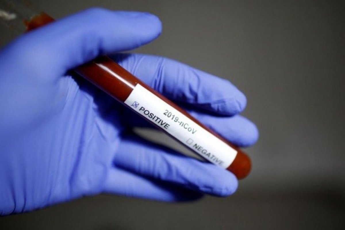 Portal da Transparência: Covid-19 faz despesa pública disparar e se tornar a maior em cinco anos