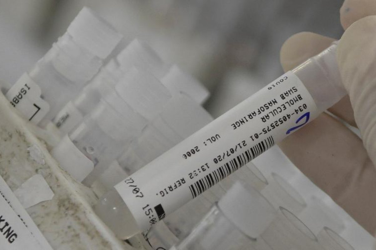 Ministério da Saúde recebe estudo para ampliar validade de testes de Covid-19