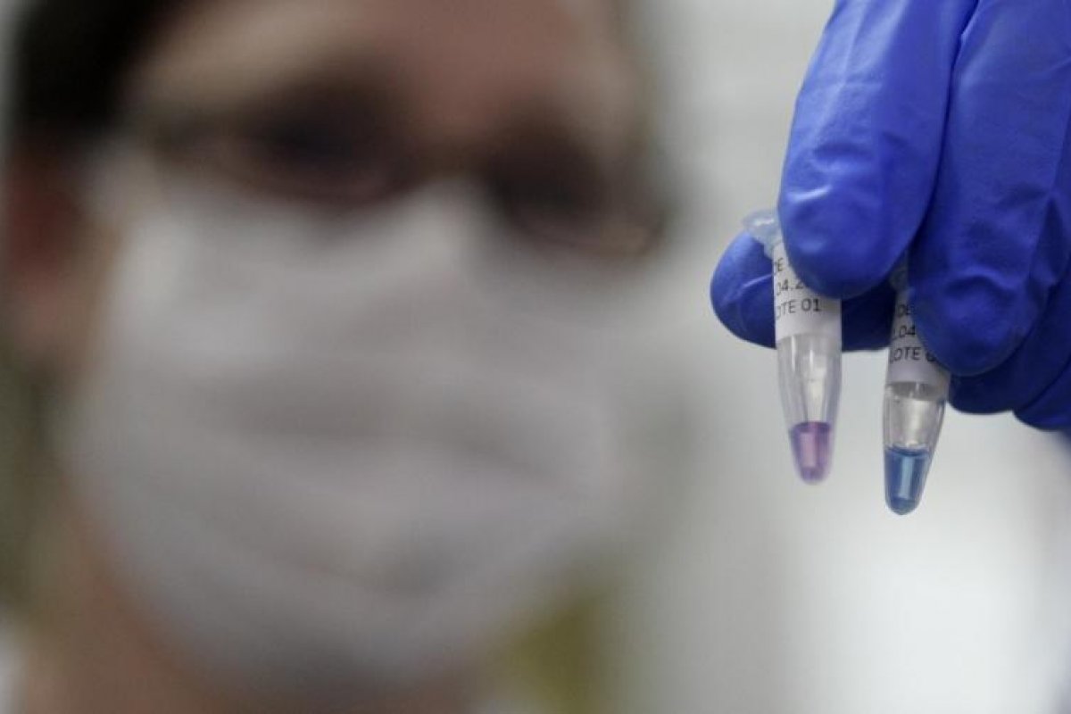 Fiocruz aponta tendência em aumento de casos de síndrome respiratória aguda grave no Brasil