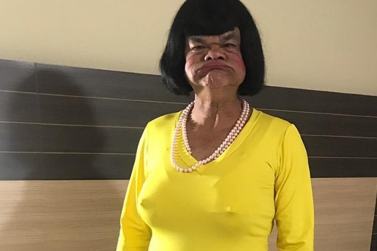 Tristeza! Humorista Rodela é internado na UTI com pulmões 95% comprometidos