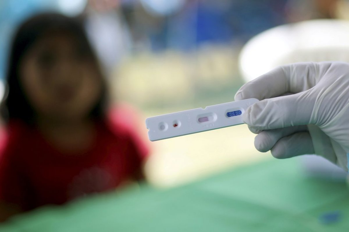 Brasil deve agir rapidamente para evitar segunda onda da covid-19, diz OMS