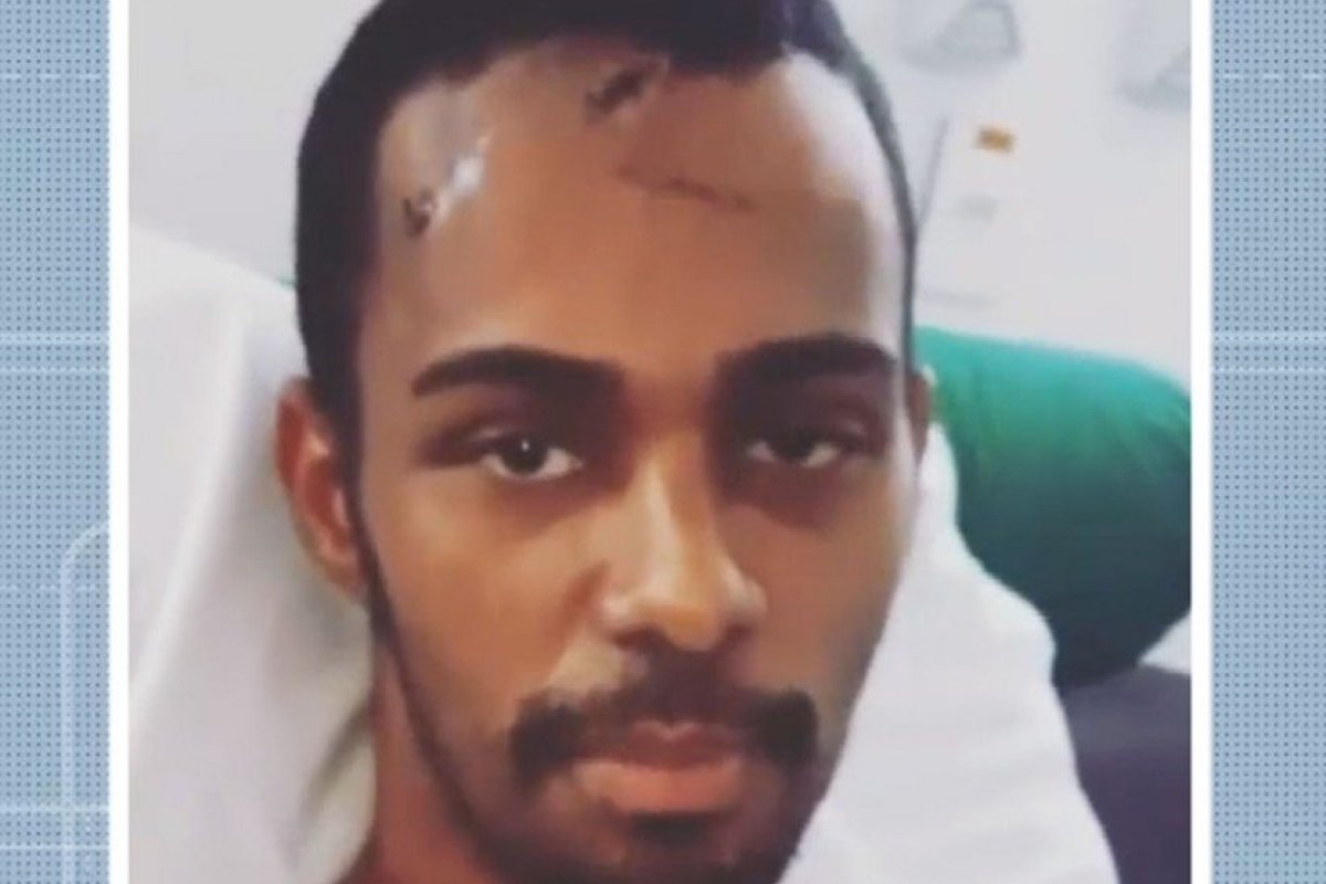 'Estou firme', diz Cabeleireiro atacado com facadas e pedradas em Salvador
