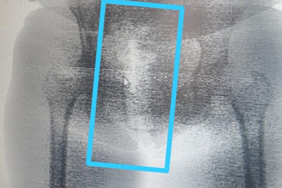 Mulheres são presas após tentar entrar em presídio com drogas escondidas em partes íntimas