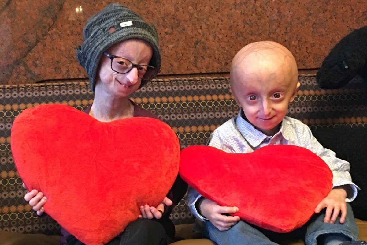 EUA aprova primeiro remédio para tratar doença progeria