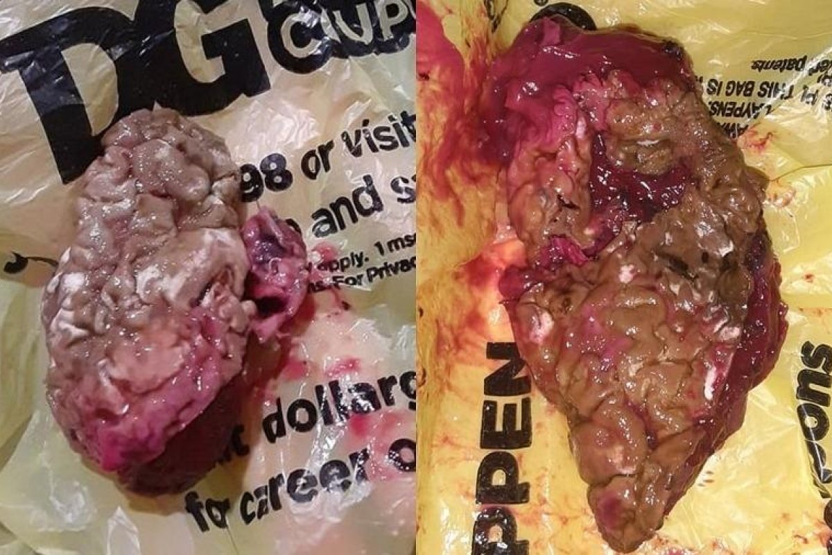 Americana liga para a polícia após comprar massinha de modelar com aparência de cérebro humano
