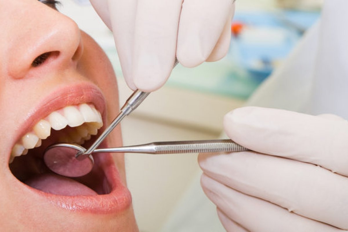 Dentista alerta para a necessidade da profilaxia para a saúde bucal